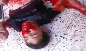 Severely injured and dying young man