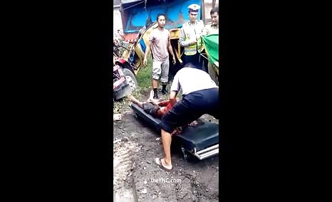 Body Ripped To Pieces By A Truck Accident