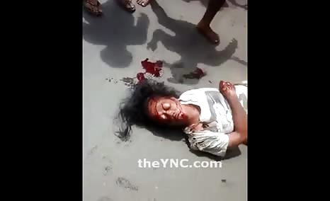 Woman Crushed Under The Truck And Alive